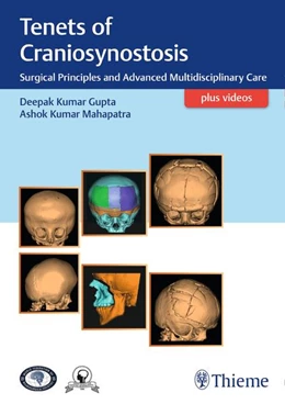 Abbildung von Gupta / Mahapatra | Tenets of Craniosynostosis | 1. Auflage | 2019 | beck-shop.de