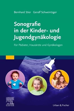 Abbildung von Schweintzger / Stier | Sonografie in der Kinder- und Jugendgynäkologie | 1. Auflage | 2019 | beck-shop.de