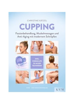 Abbildung von Kätzel | Cupping | 1. Auflage | 2019 | beck-shop.de