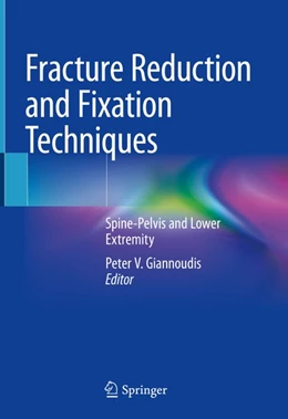 Abbildung von Giannoudis | Fracture Reduction and Fixation Techniques | 1. Auflage | 2020 | beck-shop.de