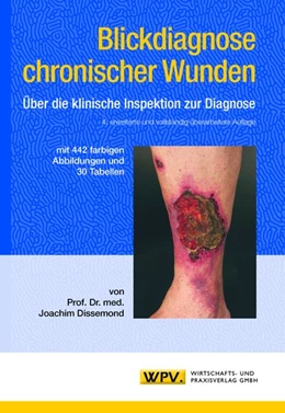 Abbildung von Dissemond | Blickdiagnose chronischer Wunden | 4. Auflage | 2020 | beck-shop.de