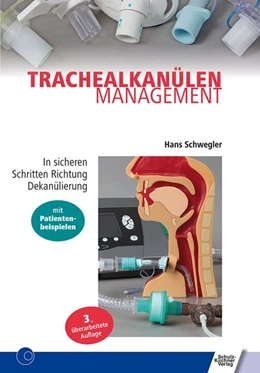 Abbildung von Schwegler | Trachealkanülenmanagement | 4. Auflage | 2019 | beck-shop.de