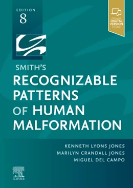 Abbildung von Jones / del Campo | Smith's Recognizable Patterns of Human Malformation | 8. Auflage | 2021 | beck-shop.de