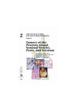 Abbildung von Tumors of the Prostate Gland, Seminal Vesicles, Penis, and Scrotum | 1. Auflage | 2020 | beck-shop.de