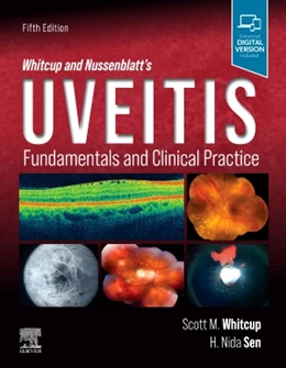 Abbildung von Whitcup / Sen | Whitcup and Nussenblatt's Uveitis | 5. Auflage | 2021 | beck-shop.de