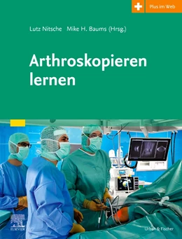 Abbildung von Nitsche / Baums | Arthroskopieren lernen | 1. Auflage | 2021 | beck-shop.de