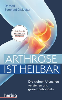 Abbildung von Dickreiter | Arthrose ist heilbar | 1. Auflage | 2021 | beck-shop.de