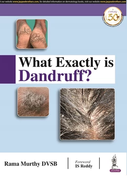 Abbildung von DVSB | What Exactly is Dandruff? | 1. Auflage | 2020 | beck-shop.de