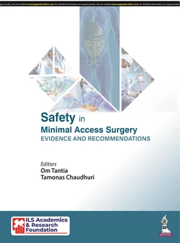 Abbildung von Tantia / Chaudhuri | Safety in Minimal Access Surgery | 1. Auflage | 2021 | beck-shop.de