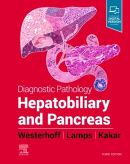 Abbildung von Lamps / Westerhoff | Diagnostic Pathology : Hepatobiliary and Pancreas | 3. Auflage | 2021 | beck-shop.de