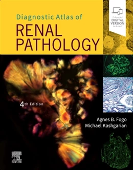 Abbildung von Fogo / Kashgarian | Diagnostic Atlas of Renal Pathology | 4. Auflage | 2021 | beck-shop.de