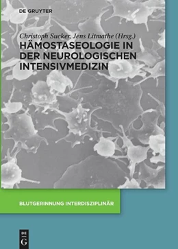 Abbildung von Sucker / Litmathe | Hämostaseologie in der neurologischen Intensivmedizin | 1. Auflage | 2021 | beck-shop.de