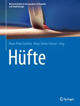 Abbildung von Günther / Schaser | Hüfte | 1. Auflage | 2021 | beck-shop.de