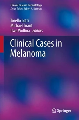 Abbildung von Lotti / Tirant | Clinical Cases in Melanoma | 1. Auflage | 2020 | beck-shop.de