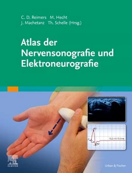 Abbildung von Hecht / Machetanz | Atlas der Nervensonografie und Elektroneurografie | 1. Auflage | 2022 | beck-shop.de
