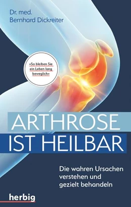 Abbildung von Dickreiter | Arthrose ist heilbar | 1. Auflage | 2021 | beck-shop.de