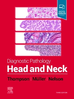 Abbildung von Thompson / Müller | Diagnostic Pathology: Head and Neck | 3. Auflage | 2022 | beck-shop.de