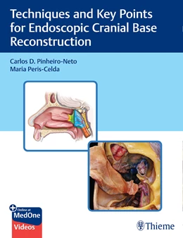 Abbildung von Pinheiro-Neto / Peris-Celda | Techniques and Key Points for Endoscopic Cranial Base Reconstruction | 1. Auflage | 2022 | beck-shop.de