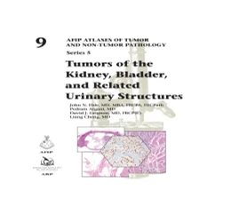 Abbildung von Tumors of the Kidney, Bladder, and Related Urinary Structures | 1. Auflage | 2021 | beck-shop.de