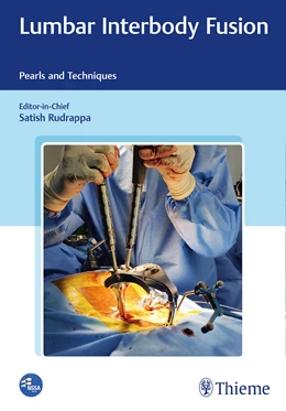 Abbildung von Rudrappa | Lumbar Interbody Fusion | 1. Auflage | 2021 | beck-shop.de