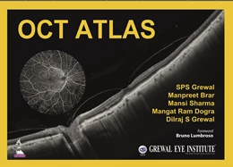 Abbildung von Grewal / Brar | OCT Atlas | 1. Auflage | 2021 | beck-shop.de