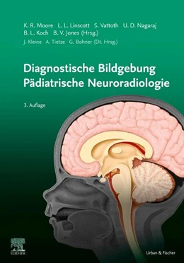 Abbildung von Moore | Diagnostische Bildgebung Pädiatrische Neuroradiologie | 3. Auflage | 2022 | beck-shop.de