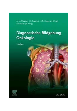 Abbildung von Akram M. / Gebauer | Diagnostische Bildgebung Onkologie | 1. Auflage | 2022 | beck-shop.de