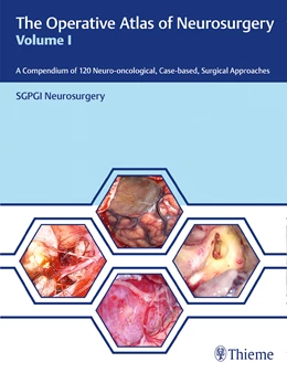 Abbildung von The Operative Atlas of Neurosurgery, Vol I | 1. Auflage | 2022 | beck-shop.de