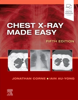 Abbildung von Corne / Au-Yong | Chest X-Ray Made Easy | 5. Auflage | 2022 | beck-shop.de