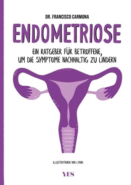 Abbildung von Carmona | Endometriose | 1. Auflage | 2022 | beck-shop.de