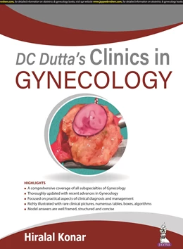 Abbildung von Konar | DC Dutta's Clinics in Gynecology | 1. Auflage | 2021 | beck-shop.de