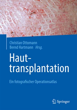 Abbildung von Ottomann / Hartmann | Hauttransplantation | 1. Auflage | 2023 | beck-shop.de