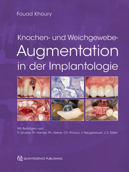 Abbildung von Khoury | Knochen- und Weichgewebeaugmentation in der Implantologie | 1. Auflage | 2024 | beck-shop.de