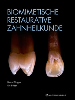 Abbildung von Magne / Belser | Biomimetische Restaurative Zahnheilkunde | 2. Auflage | 2023 | beck-shop.de