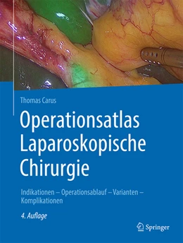 Abbildung von Carus | Operationsatlas Laparoskopische Chirurgie | 4. Auflage | 2024 | beck-shop.de