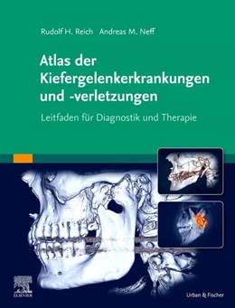 Abbildung von Reich | Atlas der Kiefergelenkerkrankungen und -verletzungen | 1. Auflage | 2022 | beck-shop.de