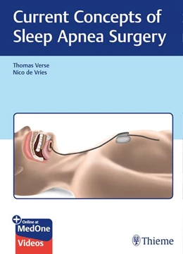 Abbildung von Verse / De Vries | Current Concepts of Sleep Apnea Surgery | 1. Auflage | 2019 | beck-shop.de