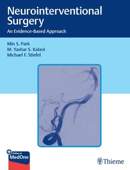 Abbildung von Park / Kalani | Neurointerventional Surgery | 1. Auflage | 2021 | beck-shop.de