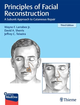 Abbildung von Larrabee / Sherris | Principles of Facial Reconstruction | 3. Auflage | 2021 | beck-shop.de