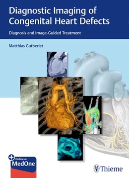 Abbildung von Gutberlet | Diagnostic Imaging of Congenital Heart Defects | 1. Auflage | 2020 | beck-shop.de