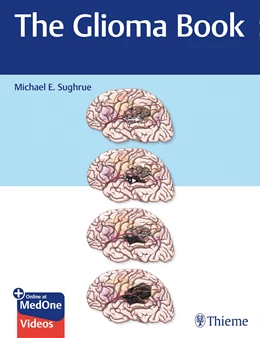 Abbildung von Sughrue | The Glioma Book | 1. Auflage | 2020 | beck-shop.de