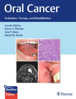 Abbildung von Fakhry / Pitman | Oral Cancer | 1. Auflage | 2020 | beck-shop.de