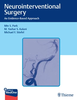Abbildung von Park / Kalani | Neurointerventional Surgery | 1. Auflage | 2021 | beck-shop.de