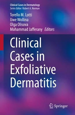 Abbildung von Lotti / Wollina | Clinical Cases in Exfoliative Dermatitis | 1. Auflage | 2022 | beck-shop.de