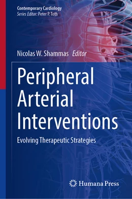 Abbildung von Shammas | Peripheral Arterial Interventions | 1. Auflage | 2022 | beck-shop.de