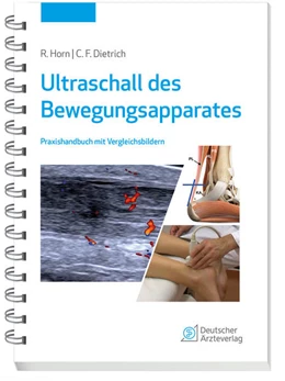 Abbildung von Horn / Dietrich | Ultraschall des Bewegungsapparates | 1. Auflage | 2022 | beck-shop.de