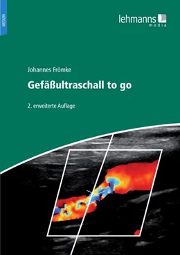 Abbildung von Frömke | Gefäßultraschall to go | 2. Auflage | 2022 | beck-shop.de