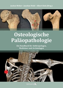 Abbildung von Weber / Wahl | Osteologische Paläopathologie | 1. Auflage | 2022 | beck-shop.de