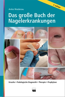 Abbildung von Niederau | Das große Buch der Nagelerkrankungen | 5. Auflage | 2022 | beck-shop.de