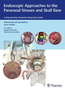 Abbildung von Bernal-Sprekelsen / Alobid | Endoscopic Approaches to the Paranasal Sinuses and Skull Base | 1. Auflage | 2017 | beck-shop.de